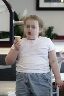 Дети страдают ожирением