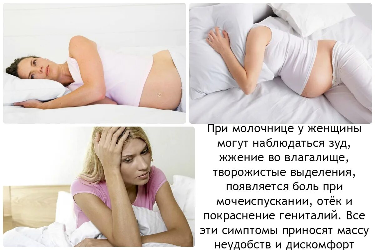 Кандидоз при беременности. Беременные женщины при кандидозе. Молочница при беременносьт. Кандидоз при беременности. Кандидоз при беременности.