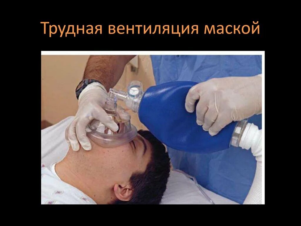 Детский 3д принтер. Упражнение аутогенная релаксация. Релаксационные методики. Ультразвуковой контроль (узк). Психологические приемы влияния на людей.