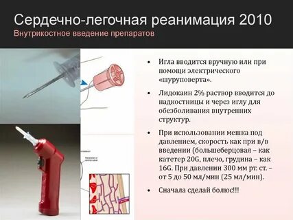Внутрикостная анестезия
