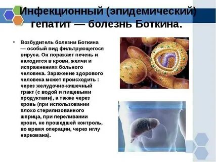 Инфекционист гепатит