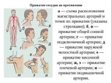 При кровотечении из раны головы прижимают
