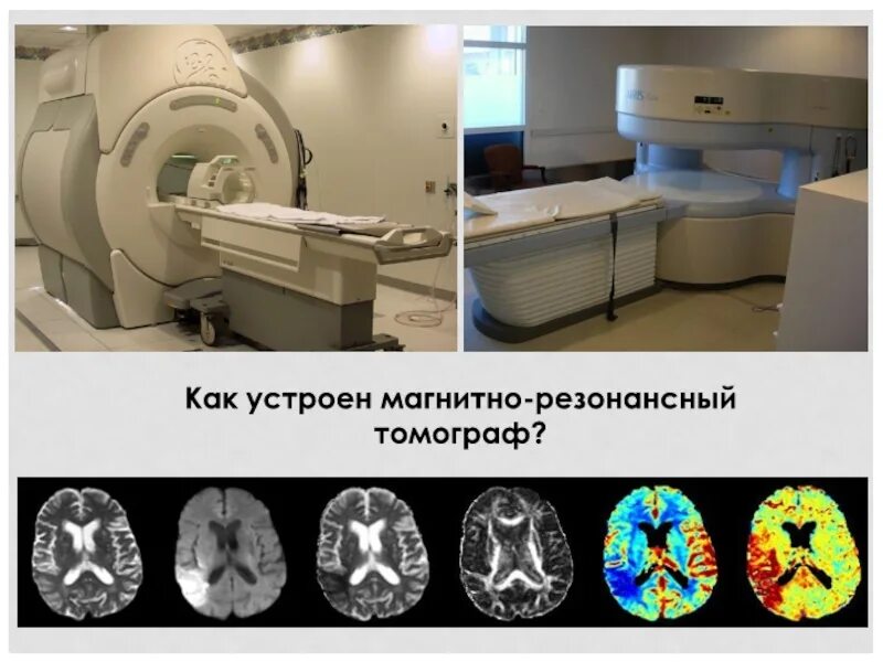 Функциональная мрт. Ангиография магнитно резонансная томография. Функциональная мрт и мрт. Магнитно резонансный томограф как устроен. Мрт балаково телефон