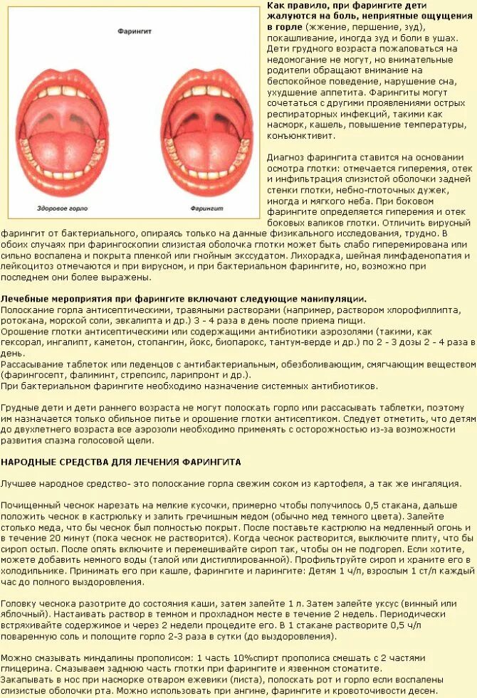 Можно ли вылечить горло без антибиотиков