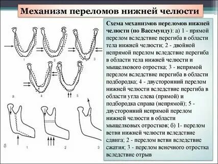 Переломы челюсти клинические рекомендации