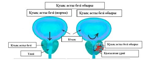 Қатты, қатты кеуделердің фотосуреттері