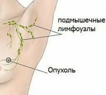 Болят подмышки после