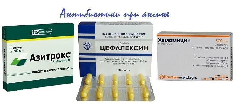 Антибиотики для лечения ангины. Цефалексин 125. лекарство от отита у взрослых антибиотик таблетки. антибиотики при ангине. антибиотики при гнойной ангине.