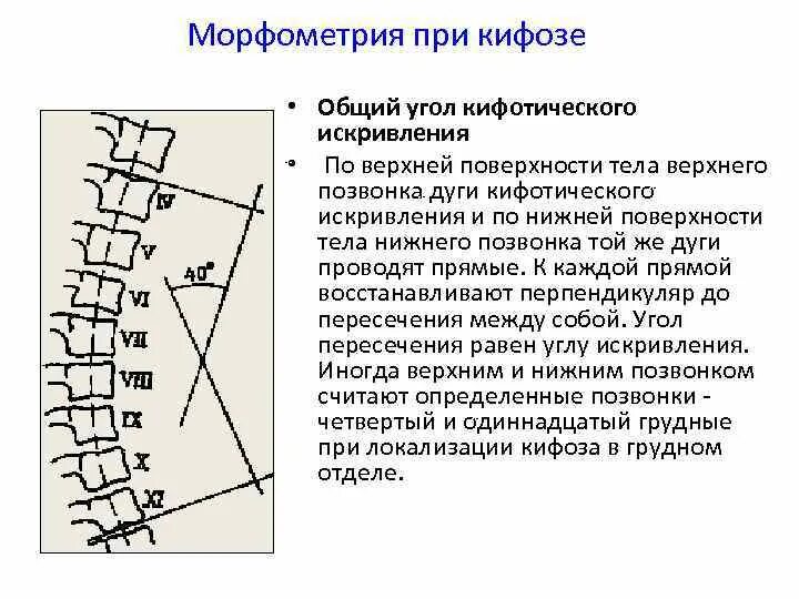 Кифоз грудного отдела позвоночника рентген степени. Измерить угол кифоза грудного отдела позвоночника. Угол физиологического кифоза грудного отдела позвоночника. Угол Кобба кифоз рентгена. Угол кобба