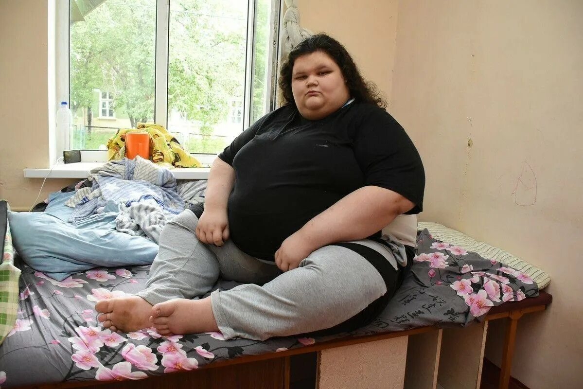 Толстая девочка 11. Жирные плдростнуи. Ожирение у подростков. Ожирение у девушек.