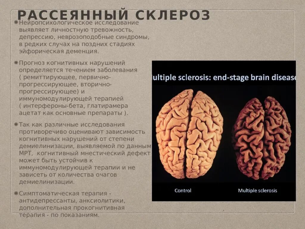 Рассеянный склероз. Болезнь рассеянный склероз. Рассеянный склероз аутоиммунное заболевание. Ранние стадии рассеянного склероза.