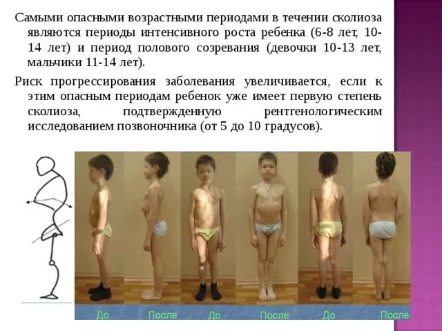 Этапы полового развития девочки. Стадии полового развития девочек. Этапы полового развития мальчика. Период полового созревания. В каком возрасте начинают расти волосы