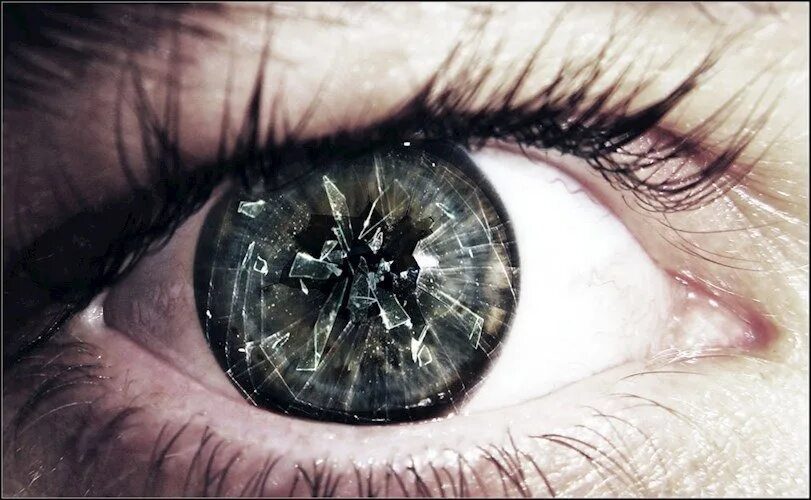 Как разбить глаз. Космос в глазах. Чел с поломанным носом. Втыкающий взгляд. Как разбить глаз.