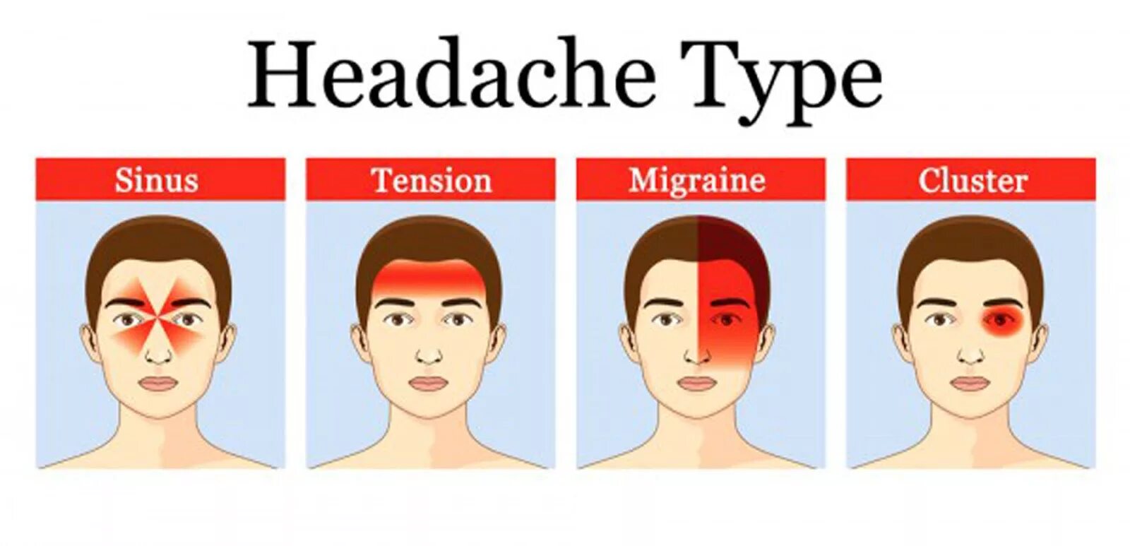 Типы головной боли. Типы головной боли и причины. Причины головной боли. Типы головной боли картинки.