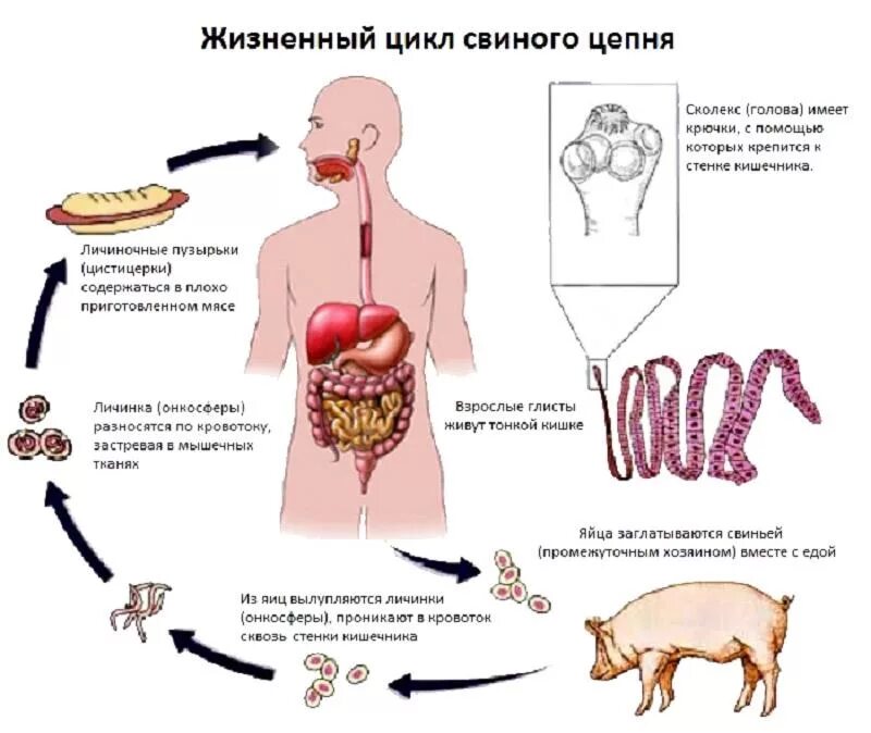 Стадии развития цепня. Цикл развития свиного цепня схема. Свиной цепень цикл развития схема. Тениоз жизненный цикл схема. Жизненный цикл свиного цепня схема.