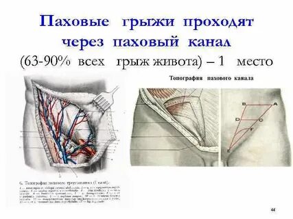 Паховая