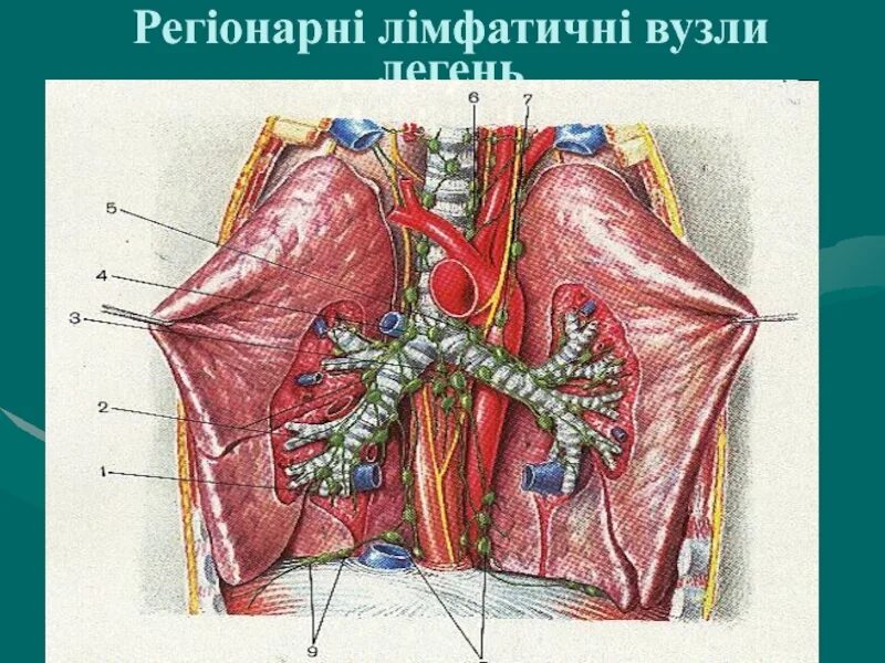 Единичные солидные узелки в легких