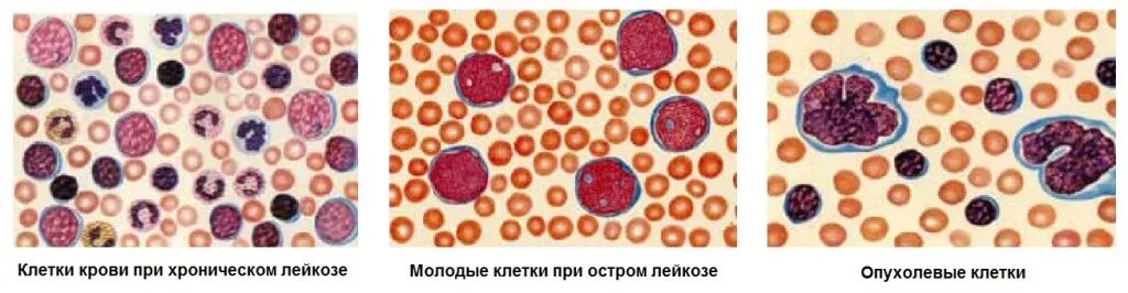 Лейкоз кошек: профилактика, лечение - советы специалистов