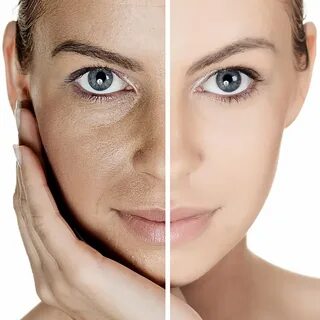 How skin