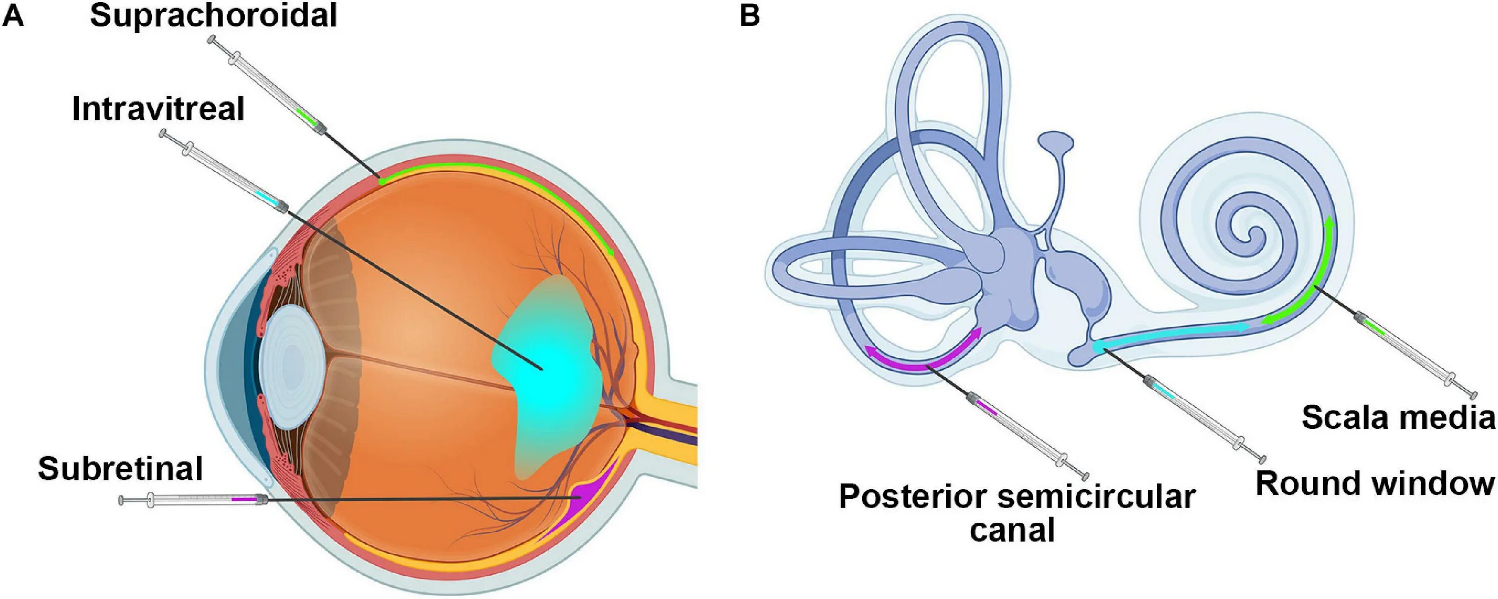 Intravitreal administration. Intravitreal administration