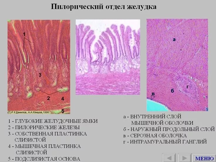 Отдел гистологии. Пилорический отдел препарат гистология. пилорическая часть желудка препарат гистология. пилорический отдел желудка гистология препарат. пилорические железы желудка гистология.