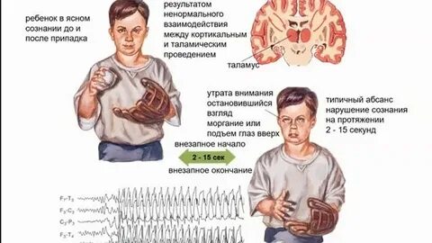 Признаки беса