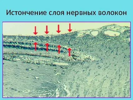 Слои нервной
