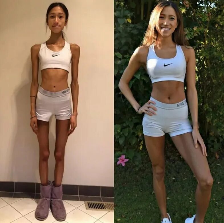 Рацион анорексички. Девушка 45 кг. Девушка 40 кг. Вес 35. Девушки весом 45 кг.