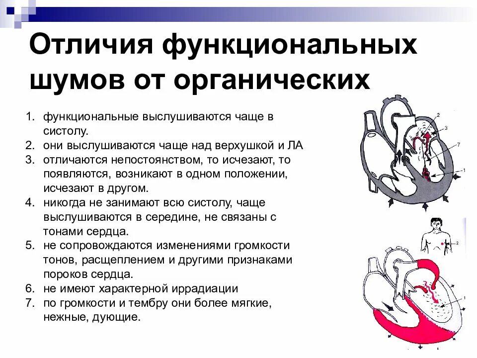 Дифференциальная диагностика сердечных шумов у детей. Классификация функциональных шумов сердца. Функциональные и органические шумы сердца у детей. Функциональные и органические шумы сердца. Характеристики функционального и органического сердечных шумов»:.