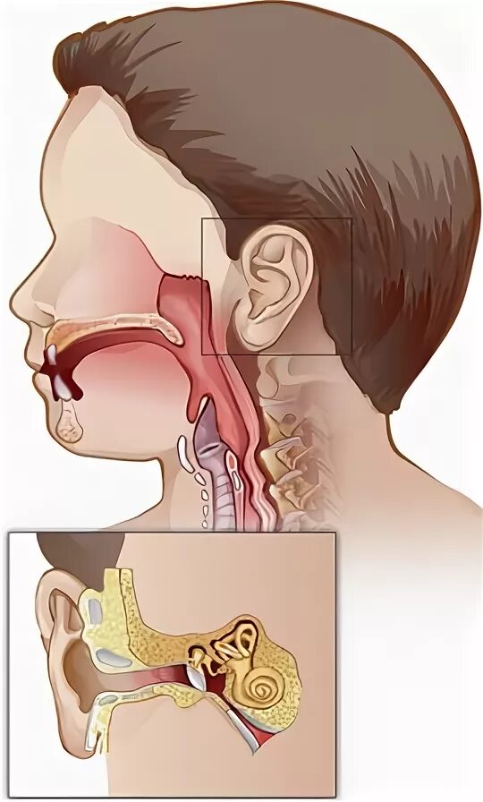 Лор органы у детей. Заболевания уха горла носа.