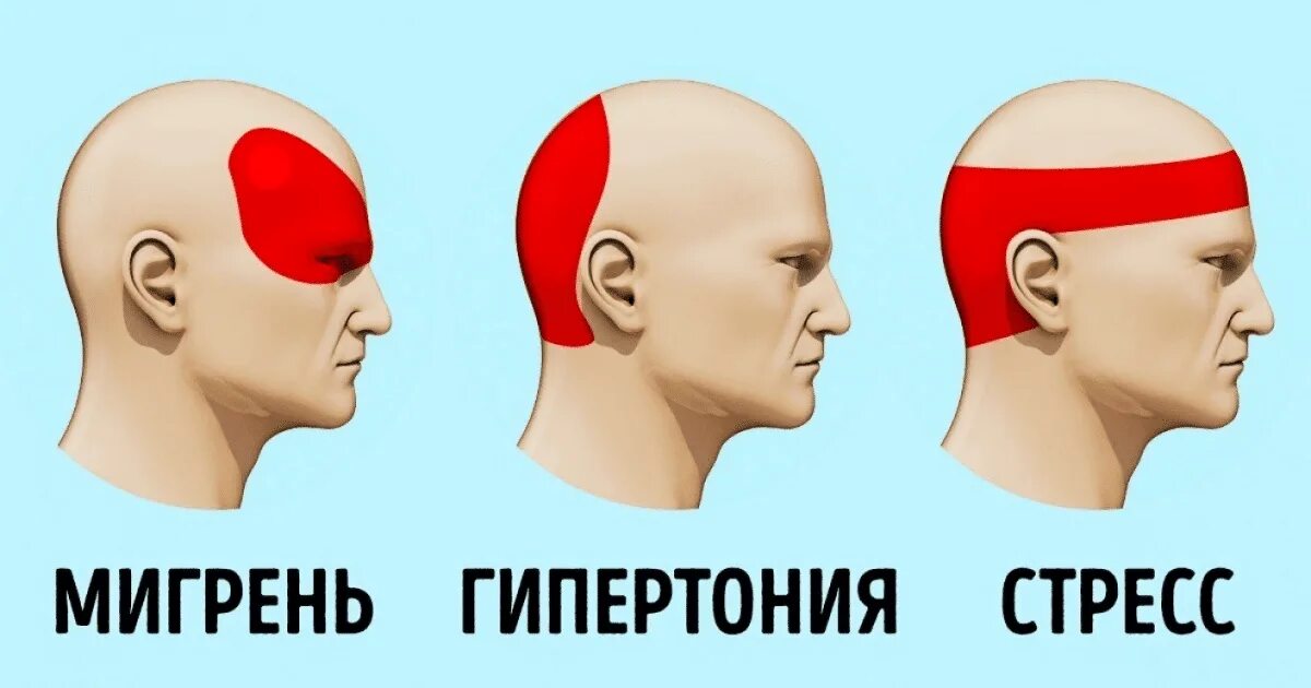 Что делать если болит голова и уши. Типы головной боли. Болит голова. Белигол ава. Мигренозные головные боли.