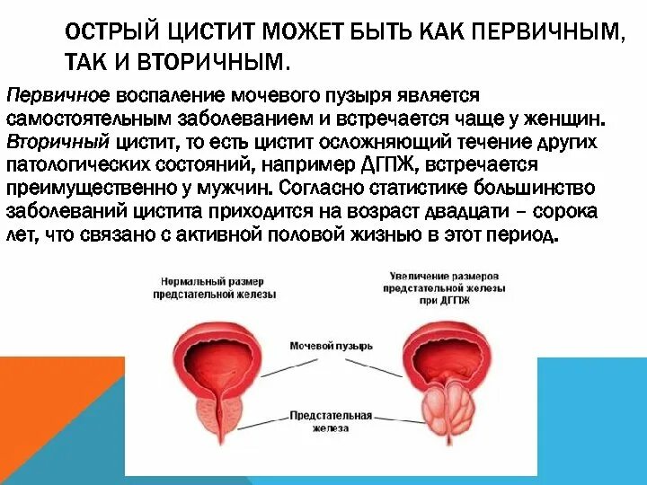 После мочевого. Воспаление мочевого пузыря. Воспалился мочевой пузырь. Воспалительные заболевания мочевого пузыря. При воспалении мочевого пузыря.