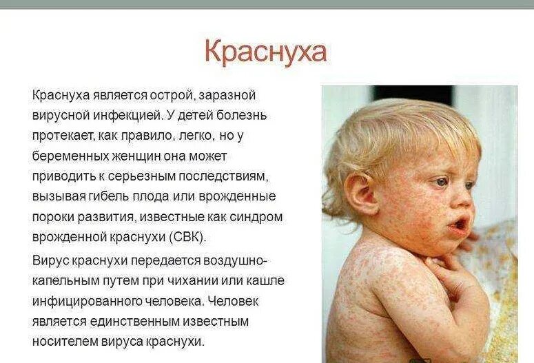 Как проявляется корь. Сыпь корь краснуха сыпь. краснуха детей симптомы заражение. краснуха и корь у детей информация.