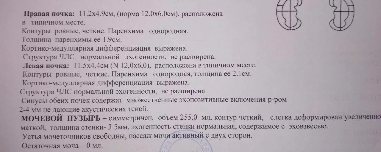 Анализ мочеточника. Результаты УЗИ почек расшифровка. Измерение почек на УЗИ норма. Почка ЧЛС на УЗИ норма. Паренхима почек на УЗИ норма.