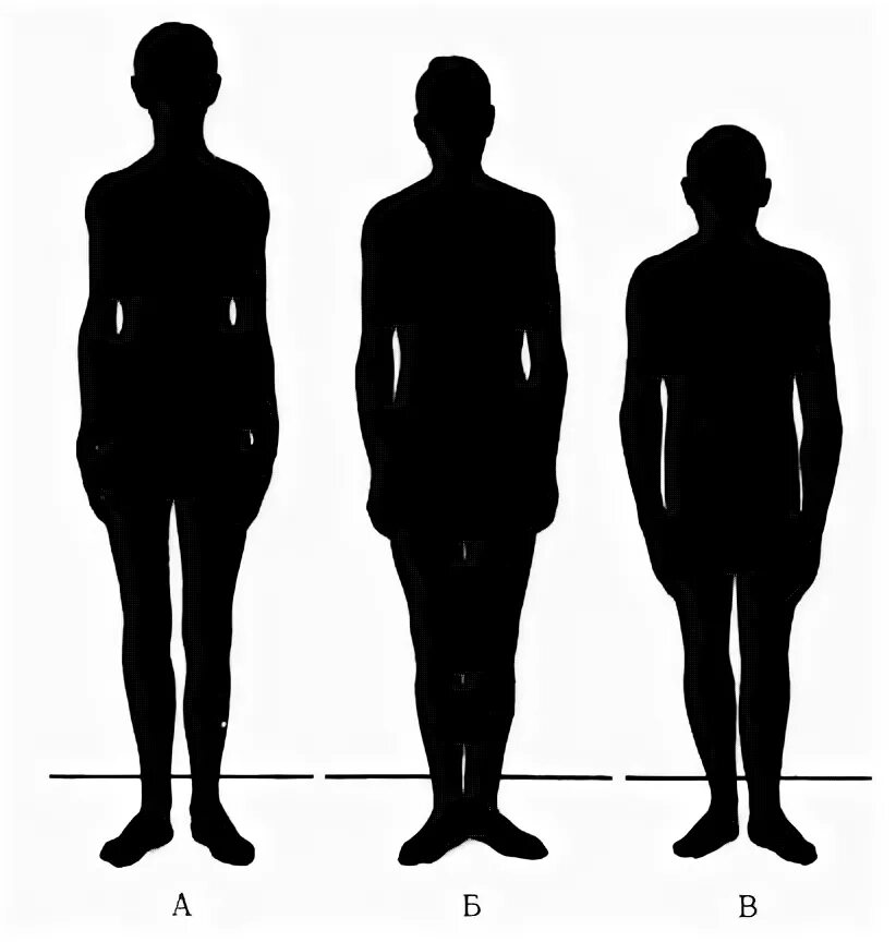 классификация типов конституции человека. типы людей по классификации черноруцкого. типы людей по классификации черноруцкого. конституциональные типы по э. конституциональные типы по черноруцкому.