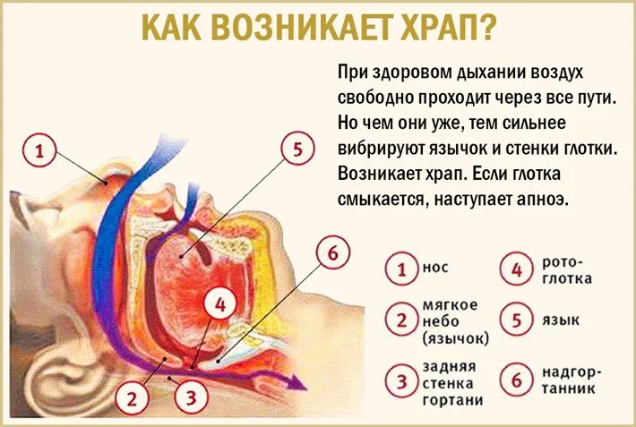 Что сделать чтобы не храпеть. Что сделать чтобы не храпеть