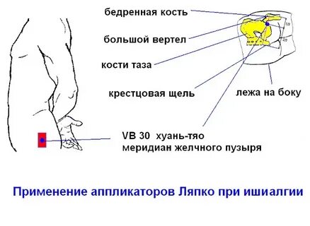 Что такое тяо