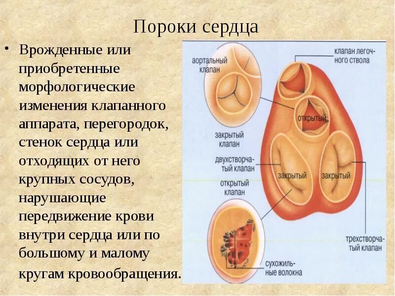 Врожденные аномалии приобретенные аномалии. Приобретенные пороки сердца. Врожденные и приобретенные пороки сердца.