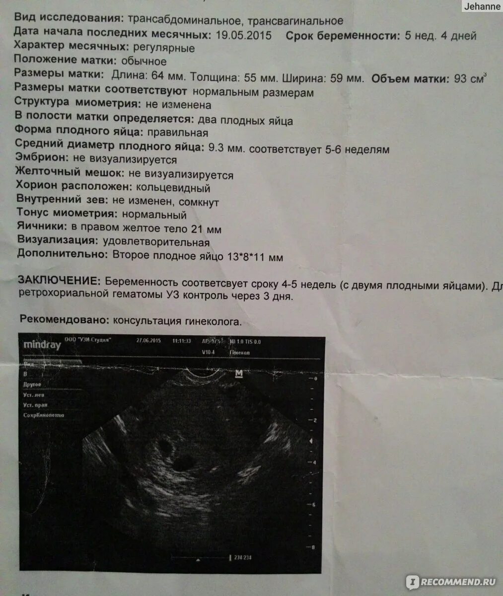 Срок беременности 3 недели узи. Плодное яйцо на 6 неделе беременности узи. узи на сроке 6 акушерских недель беременности. описание узи на ранних сроках беременности. плодное яйцо на узи на ранних сроках беременности 2 недели.