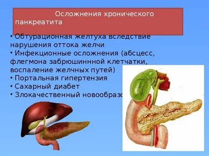 Острый панкреатит печени