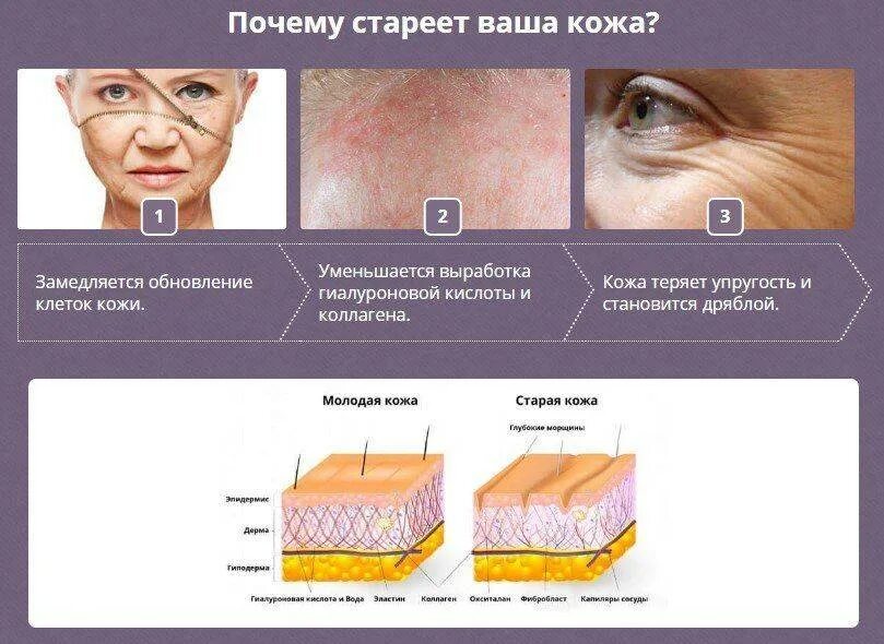 Кожному отзыв. Процесс старения кожи. Причины регенерации кожи. Старение кожи дерматология.