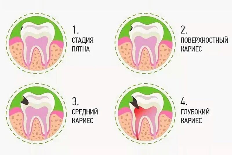 Какие зубы можно лечить