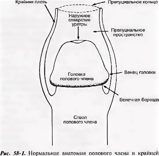 Строение крайней плоти. Обрезание у мужчин схема. Головка полового органа. Головка полового органа у детей. Плоть закрывает головку