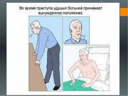 Одышка при подъеме