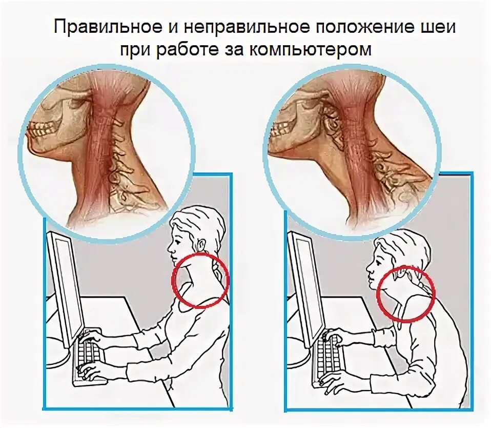 Болит шея при поворотах врач. Ощущение прилива тепла в шее. болит шея после сна. куратор плеча и шеи. что делать если болит шея после сна.