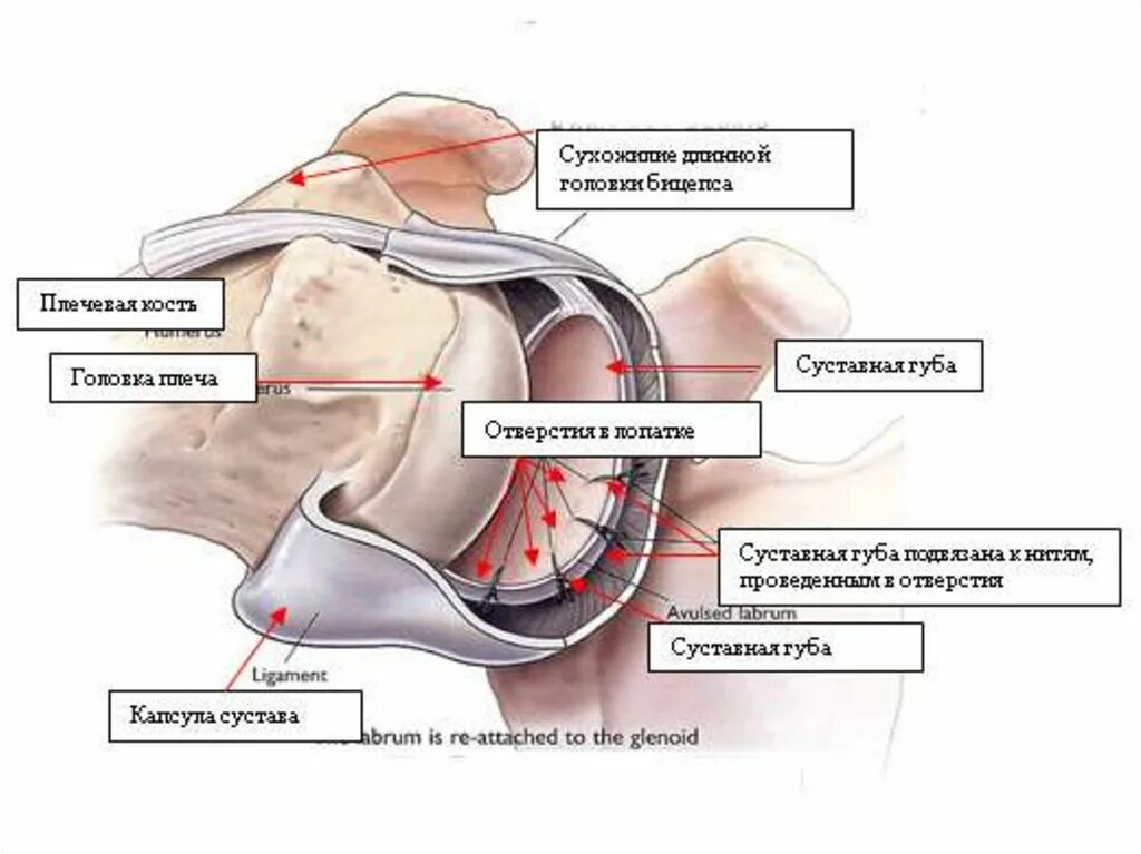 Повреждение губы плечевого сустава. Губа гленоида плечевого сустава. Повреждения губы гленоида лопатки. Фиброзно хрящевая губа гленоида лопатки. Суставная губа гленоида плечевого сустава.