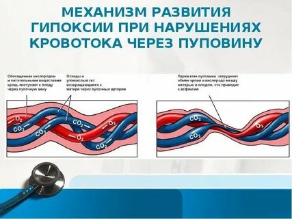 Гипоксия при нарушении кровообращения