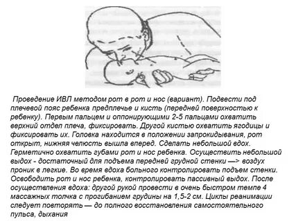Рот в нос техника