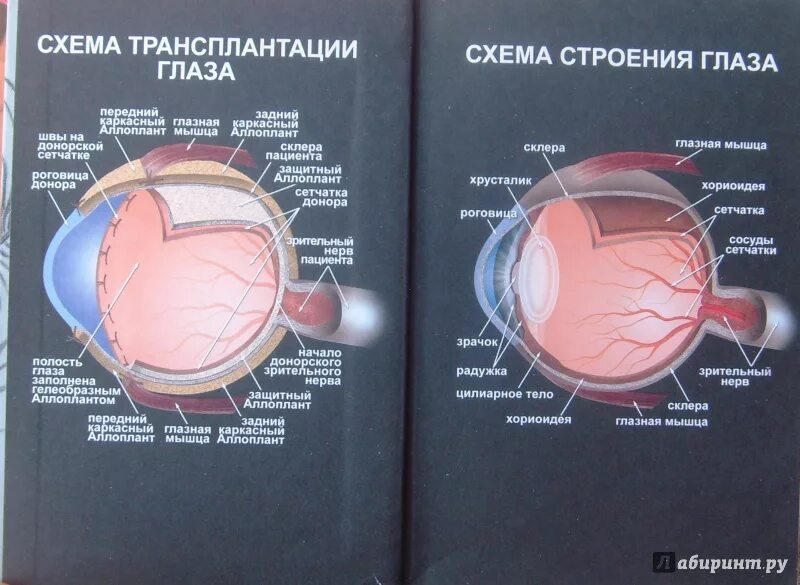 Можно пересадить глаза