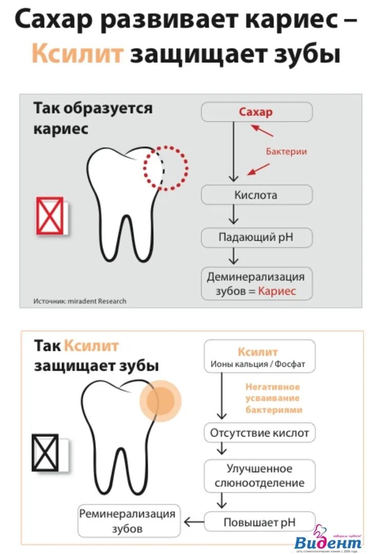 Почему появилась сахара. Кариес зубов от сахара. Причины развития кариеса. Ксилит и зубы.